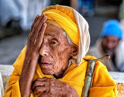 Woman covering her right eye 